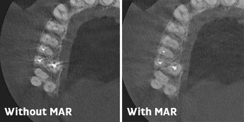 Более четкие изображения с технологией MAR