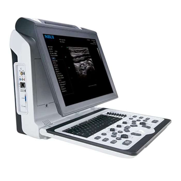 Ветеринарный аппарат УЗИ SIUI Apogee 2300V