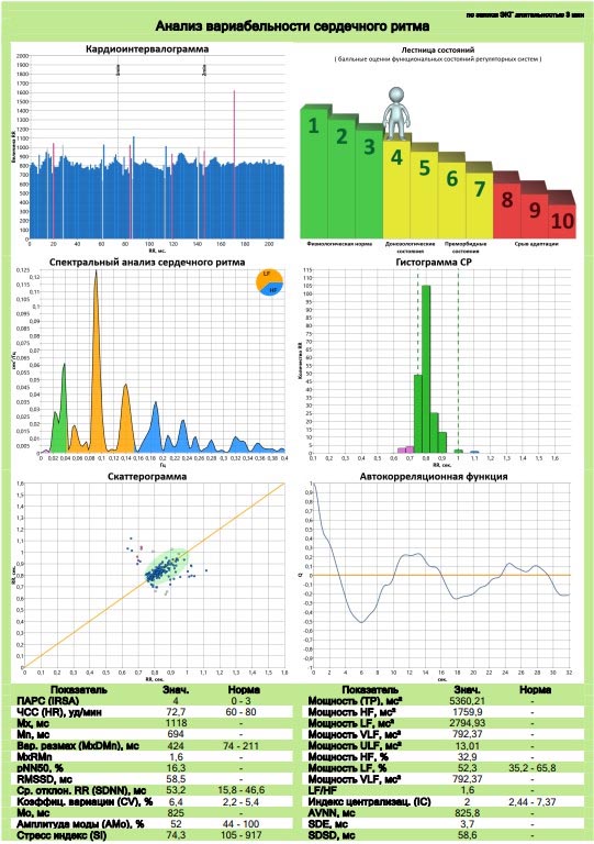 Дополнительные методы оценки ЭКГ и автоматическое заключение - изображение 3