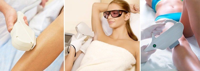 Лазерный аппарат для удаления волос навсегда в домашних условиях