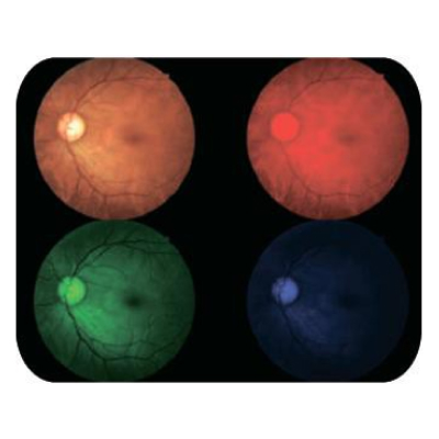 Разделение RGB
(наложение красного, синего или зеленого фильтра)
