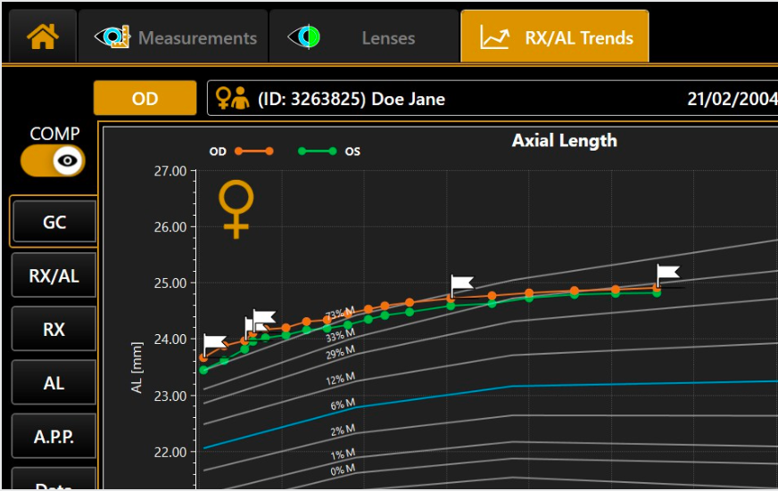 График трендов осевой длины RX/AL Trends