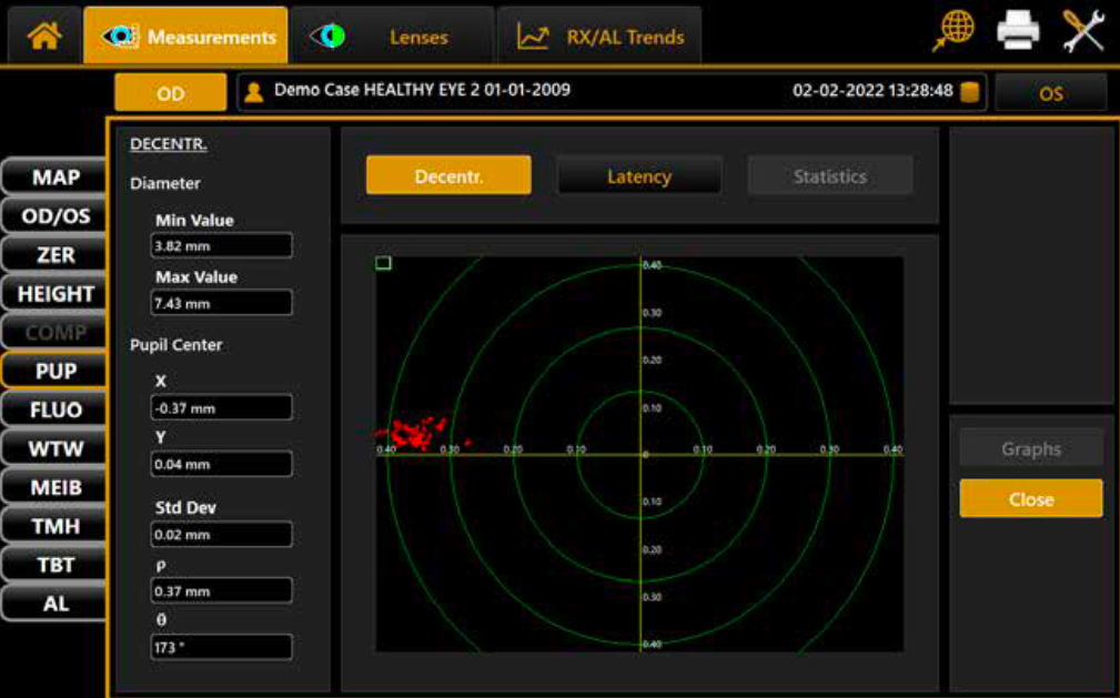 Динамическая пупиллометрия Topcon MYAH