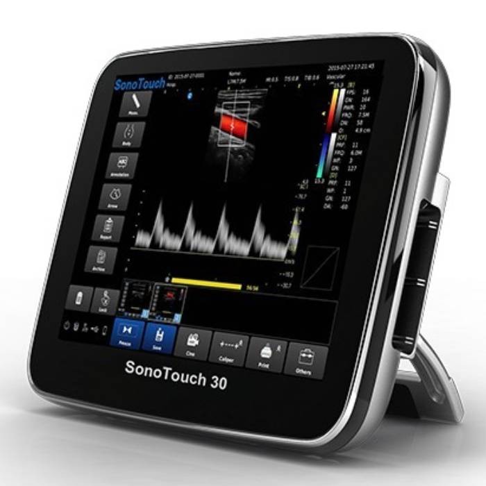 УЗИ аппарат Chison Sonotouch 30 (ECO 3) УЗИ аппарат Chison Sonotouch 30 (ECO 3)