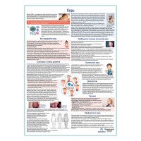 Корь медицинский плакат А1+/A2+