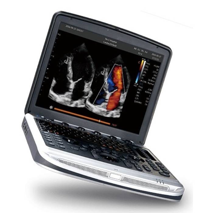 УЗИ аппарат Chison Sonotouch 80 (SonoBook 8) УЗИ аппарат Chison Sonotouch 80 (SonoBook 8)
