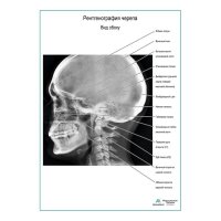 Рентгенография черепа. Вид сбоку плакат глянцевый А1+/А2+
