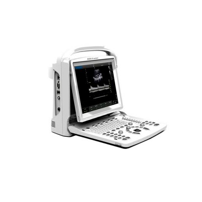 УЗИ сканер SonoTouch 20 Chison