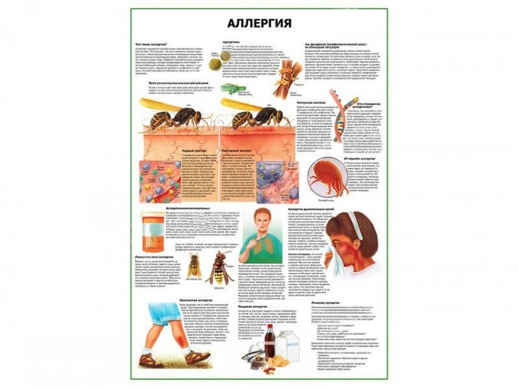Аллергия плакат глянцевый А1/А2