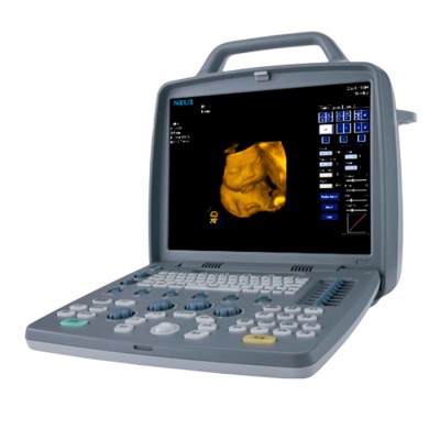 Портативный УЗИ аппарат SIUI CTS-8800 Plus Портативный УЗИ аппарат SIUI CTS-8800 Plus
