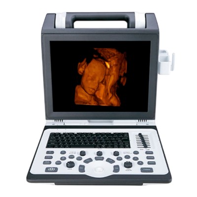 Портативный УЗИ аппарат SIUI CTS-7700 Портативный УЗИ аппарат SIUI CTS-7700