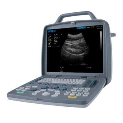 Портативный УЗИ аппарат SIUI CTS-6600 Портативный УЗИ аппарат SIUI CTS-6600