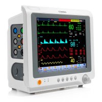 Прикроватный монитор пациента STAR8000С COMEN