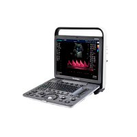 Ультразвуковой сканер S8Exp SonoScape 