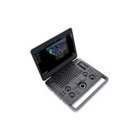 Ультразвуковой сканер S2N SonoScape 