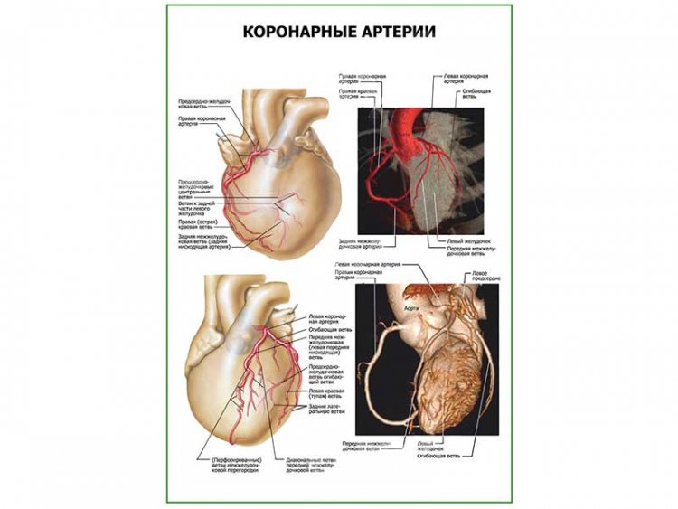 Коронарные артерии плакат глянцевый А1/А2