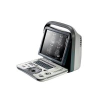 Ультразвуковой сканер A6 SonoScape