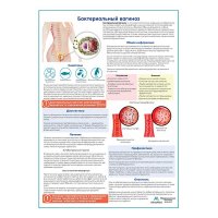 Бактериальный вагиноз медицинский плакат А1+/A2+