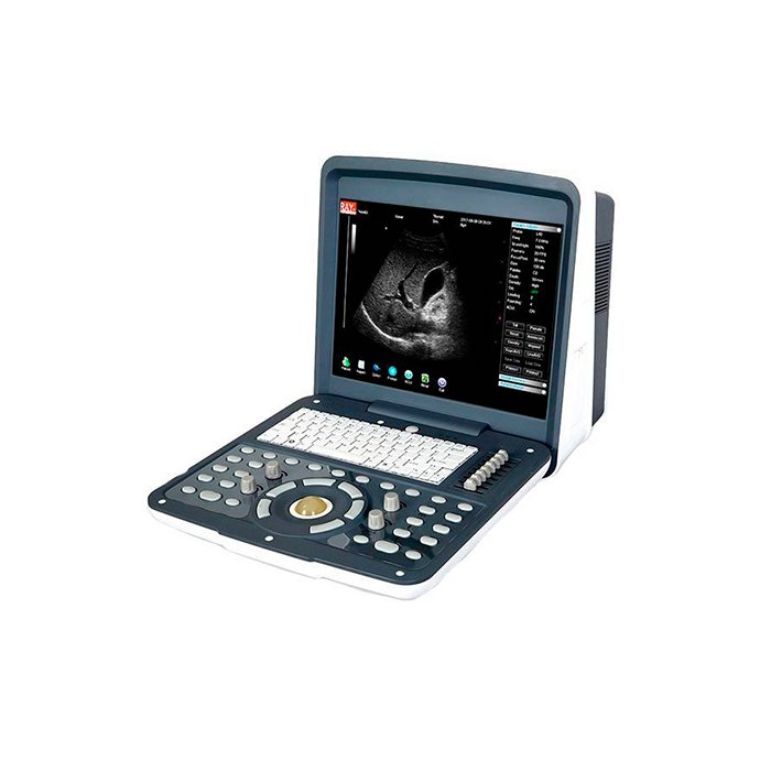 Переносной УЗИ сканер AcuVista RS880d 