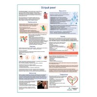 Острый ринит, медицинский плакат А1+/A2+