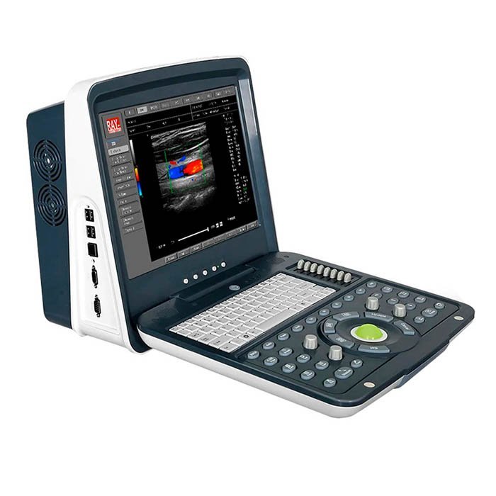 Портативный УЗИ сканер с цветным допплером AcuVista RS880i › Купить ...