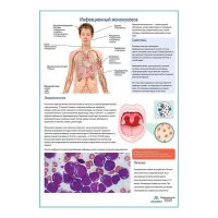 Инфекционный мононуклеоз медицинский плакат А1+/A2+