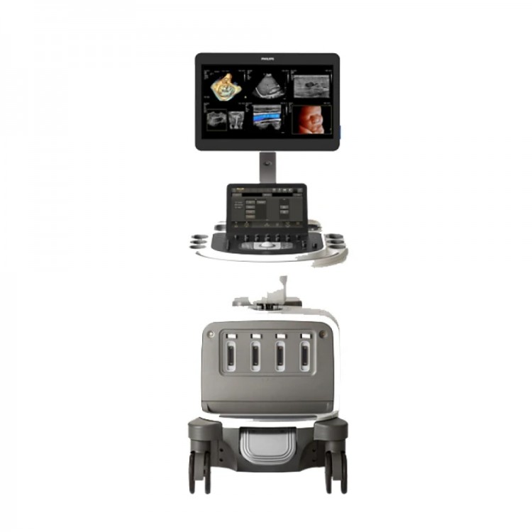 УЗИ аппарат Philips EPIQ Elite УЗИ аппарат Philips EPIQ Elite