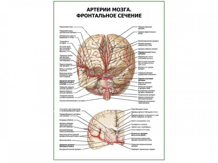 Артерии мозга. Фронтальное сечение плакат глянцевый А1/А2