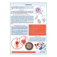 Лямблиоз медицинский плакат А1+/A2+