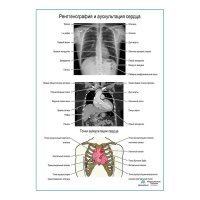Рентгенография и аускультация сердца плакат глянцевый  А1+/А2+