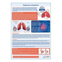 Вирусная пневмония медицинский плакат А1+/A2+