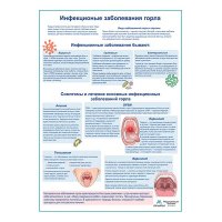 Инфекционные заболевания горла медицинский плакат А1/A2