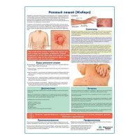 Розовый лишай (Жибера) медицинский плакат А1+/A2+