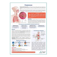 Пневмония медицинский плакат А1+/A2+