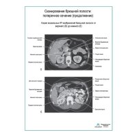 Сканирование брюшной полости: поперечное сечение (продолжение) плакат глянцевый А1+/А2+