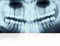 Рентгеновская пленка для стоматологии