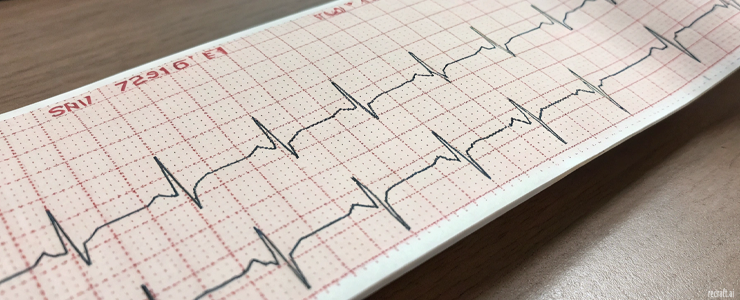 Электрокардиографы Cardioline, Италия